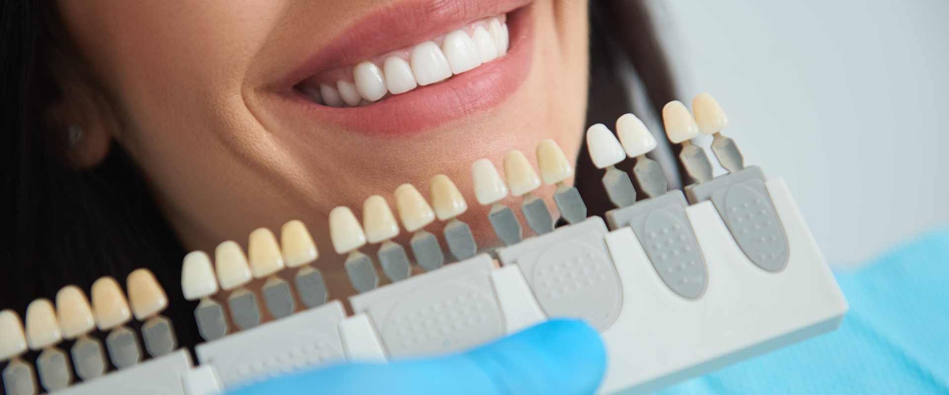 Same-day dental crown being placed on a patient's tooth